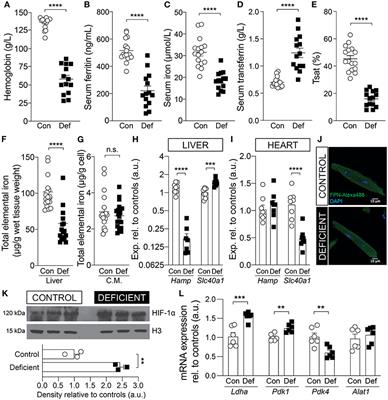 Iron-Deficiency Anemia Results in Transcriptional and Metabolic Remodeling in the Heart Toward a Glycolytic Phenotype